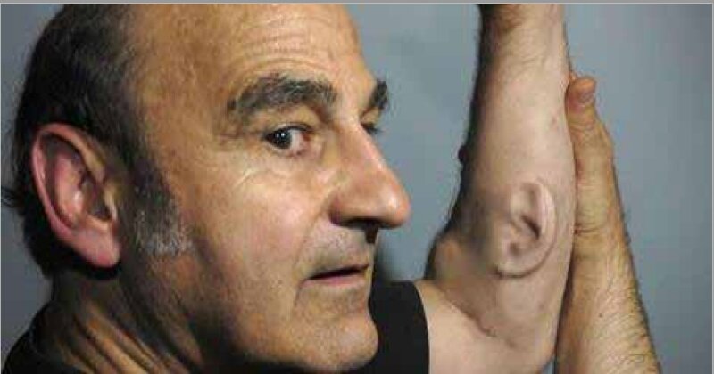 “Ear on Arm”: Stelarc. Stelarc menggunakan teknologi transmografikkasi. Menanam kuping prostetik di lengannya. Menggunakan mikroffon yang tersambung ke internet agar orang bisa mendengar yang ia dengar. Karya-karya Stelarc dipamerkan kembali dalam program “Machine/Magig”, Galeri Nasional Jakarta, November 2019.